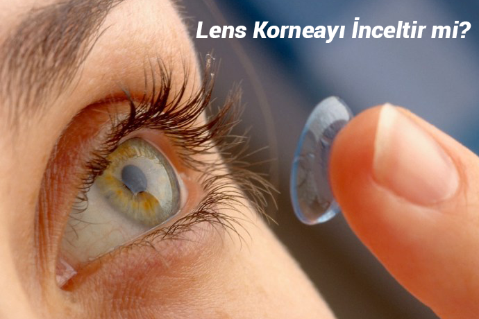 Lens Korneayı İnceltir mi? görseli