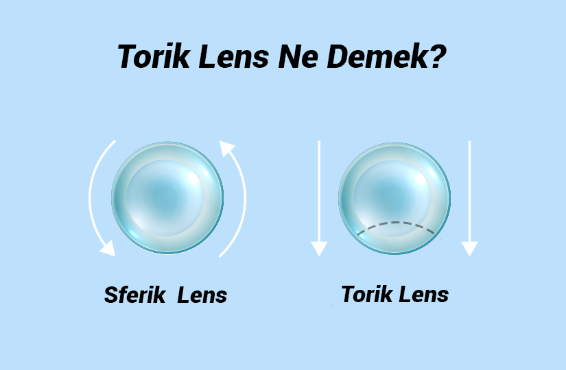 Torik Lens Ne Demek? görseli